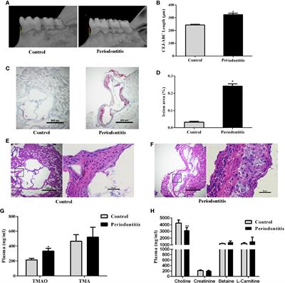 Experimental Periodontitis Deteriorated Atherosclerosis Associated With Trimethylamine N-Oxide Metabolism in Mice